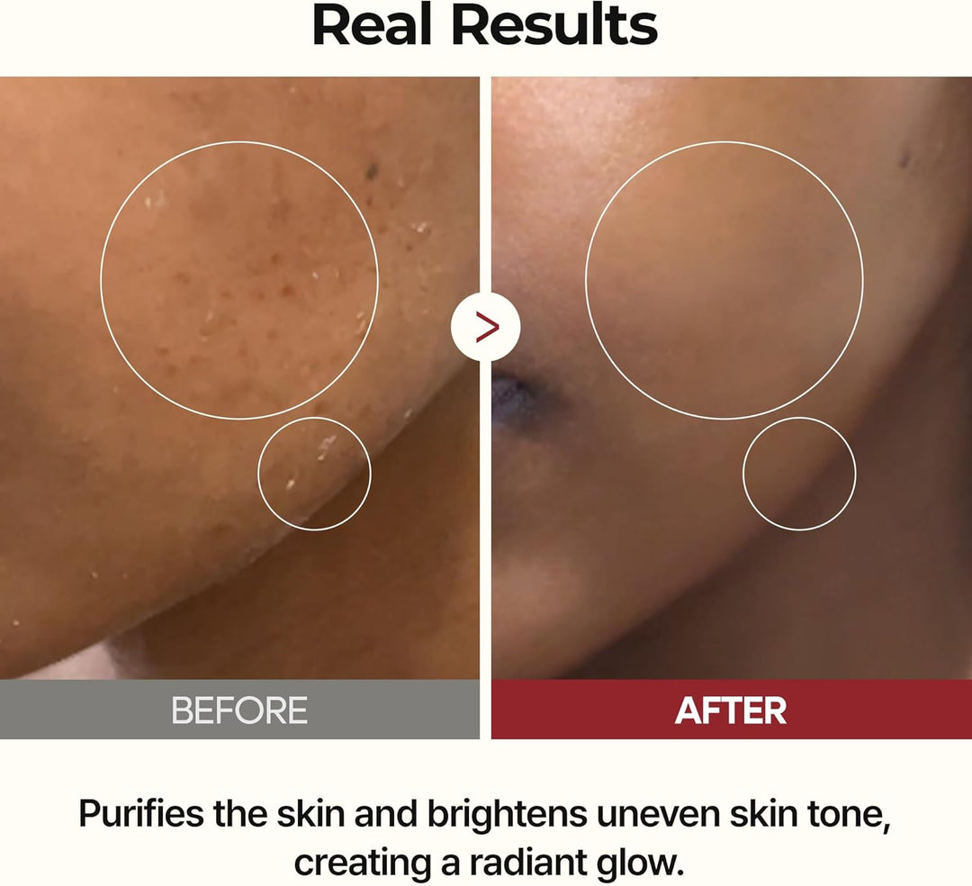 [Dr.Melaxin]  Peel Shot Glow Rice Toner 200ml