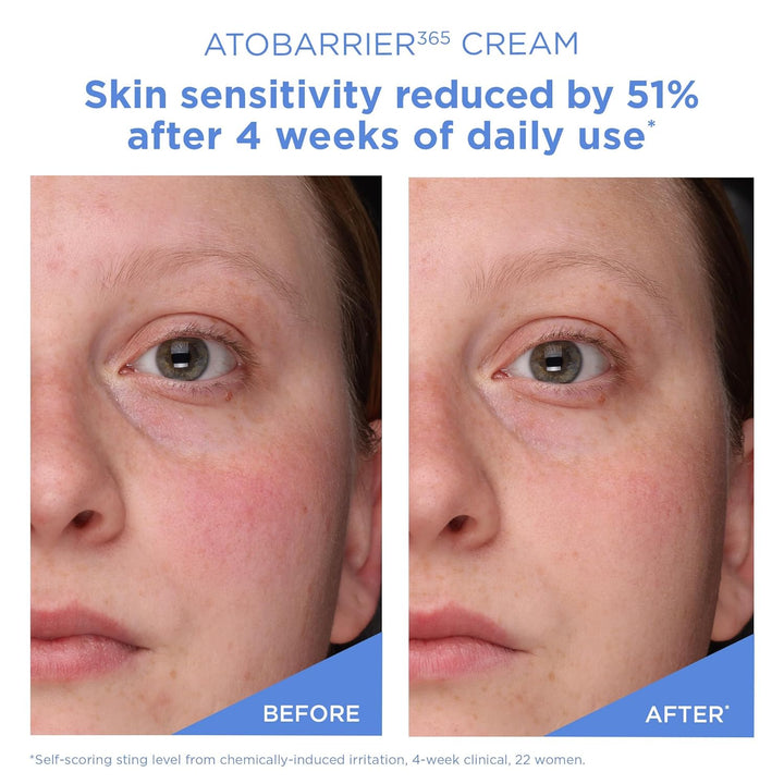 [Aestura] ATOBARRIER365 Cream 80ml