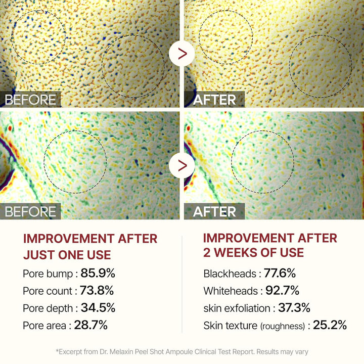 [Dr.Melaxin]  Peel Shot Glow White Rice Peeling Ampoule 80ml