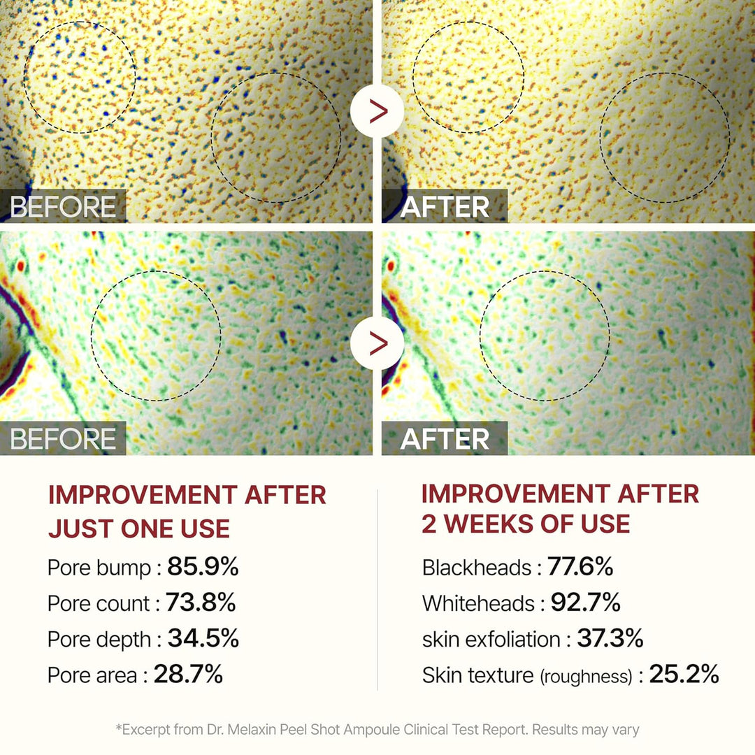 [Dr.Melaxin]  Peel Shot Glow Black Rice Peeling Ampoule 80ml