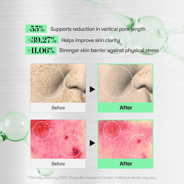 [VT COSMETICS]  CICA Reedle Shot 100 50ml